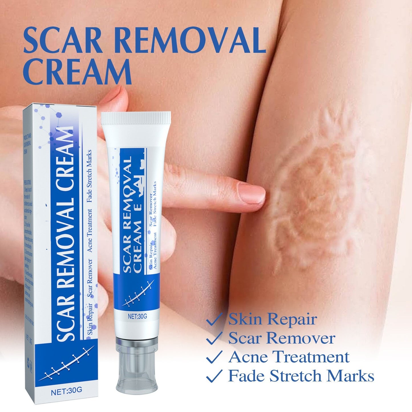 Scar wart Removal Cream