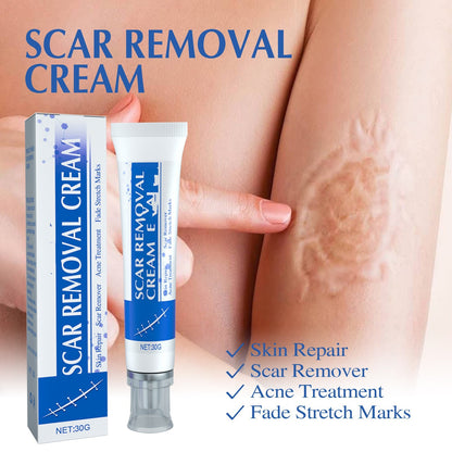 Scar wart Removal Cream