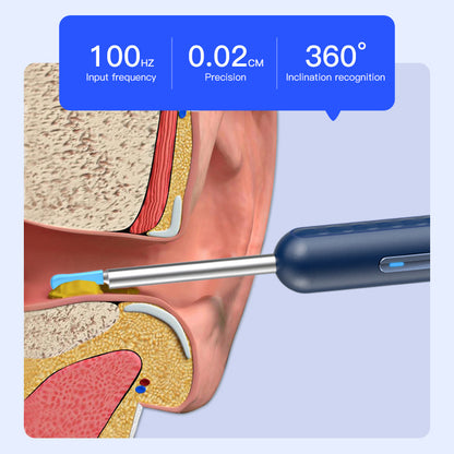 Visual Earpick Endoscope Smart WiFi